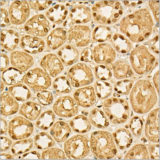 product-image-AAA10621_IHC7.jpg