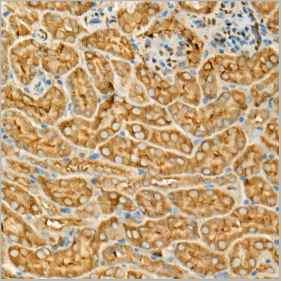 product-image-AAA10621_IHC8.jpg