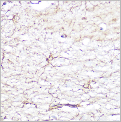 product-image-AAA10625_IHC2.jpg