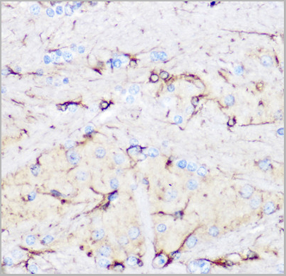 product-image-AAA10625_IHC3.jpg