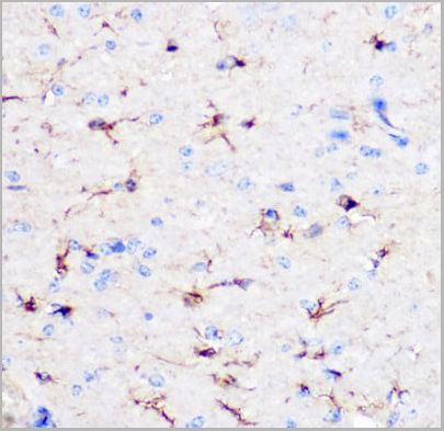product-image-AAA10625_IHC4.jpg