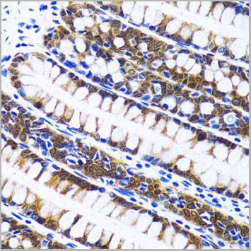 product-image-AAA10626_IHC4.jpg