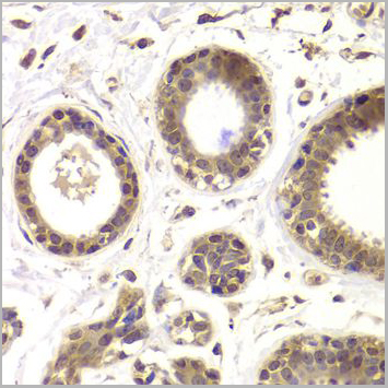 product-image-AAA10627_IHC2.jpg