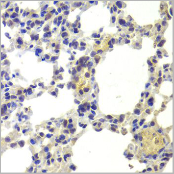 product-image-AAA10627_IHC3.jpg