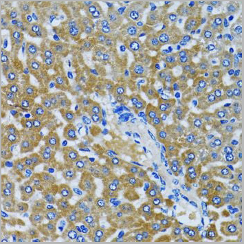product-image-AAA10627_IHC4.jpg