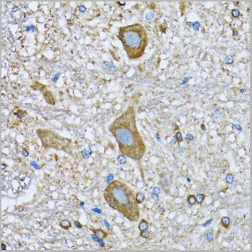 product-image-AAA10627_IHC8.jpg