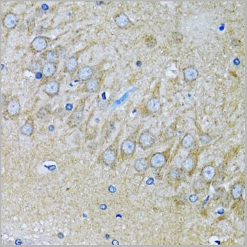 product-image-AAA10627_IHC9.jpg