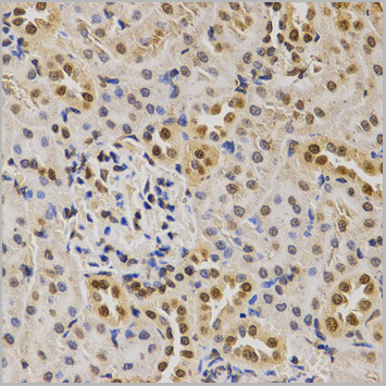 product-image-AAA10648_IHC3.jpg