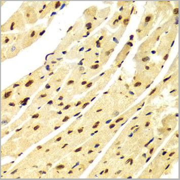 product-image-AAA10648_IHC5.jpg