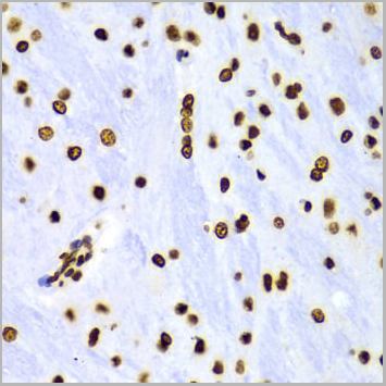 product-image-AAA10651_IHC10.jpg