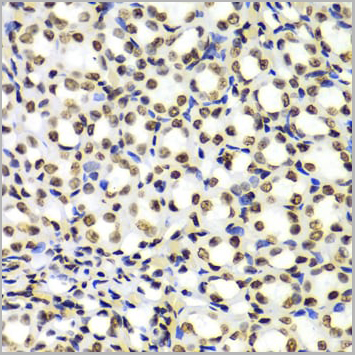 product-image-AAA10651_IHC11.jpg