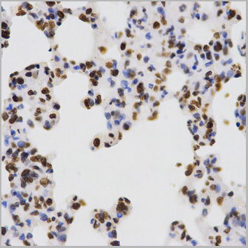 product-image-AAA10651_IHC5.jpg