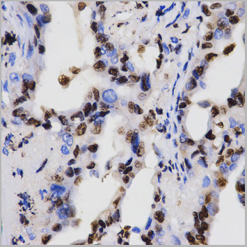 product-image-AAA10651_IHC6.jpg
