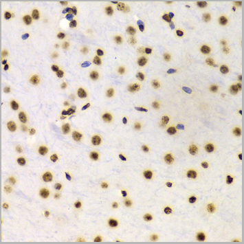 product-image-AAA10651_IHC8.jpg