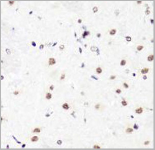 product-image-AAA10658_IHC3.jpg