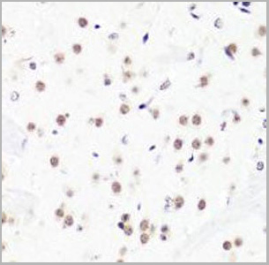 product-image-AAA10658_IHC5.jpg