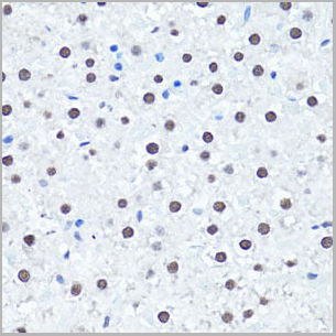 product-image-AAA10660_IHC4.jpg