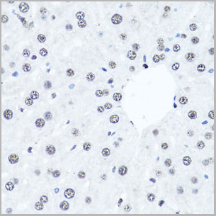 product-image-AAA10660_IHC6.jpg