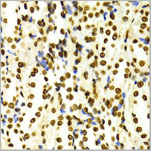 product-image-AAA10663_IHC11.jpg