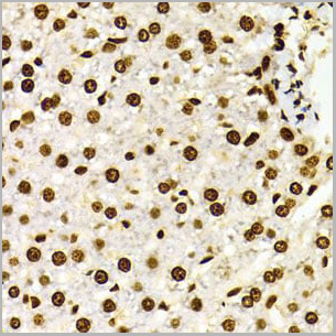 product-image-AAA10663_IHC12.jpg