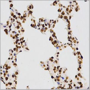 product-image-AAA10663_IHC3.jpg