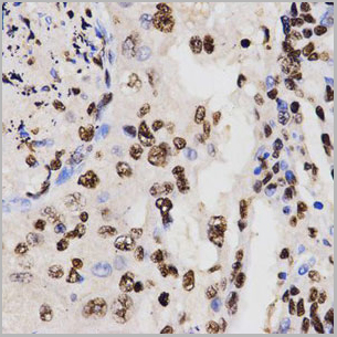 product-image-AAA10663_IHC5.jpg