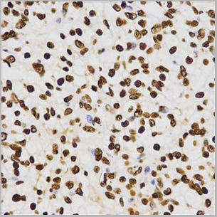 product-image-AAA10663_IHC6.jpg