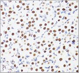 product-image-AAA10664_IHC3.jpg