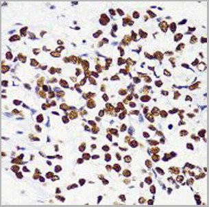 product-image-AAA10664_IHC4.jpg