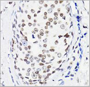 product-image-AAA10664_IHC5.jpg