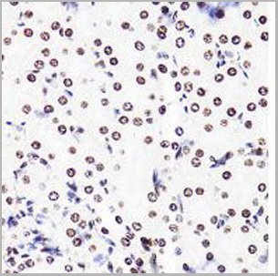 product-image-AAA10664_IHC6.jpg