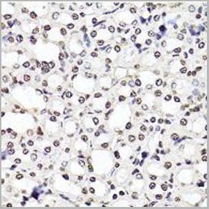 product-image-AAA10664_IHC7.jpg