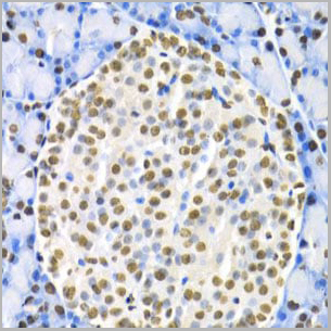product-image-AAA10685_IHC2.jpg