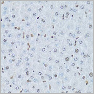 product-image-AAA10685_IHC3.jpg