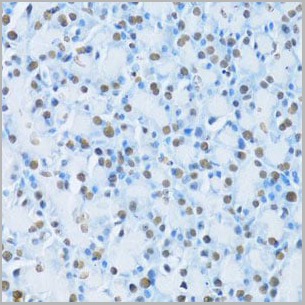 product-image-AAA10685_IHC5.jpg