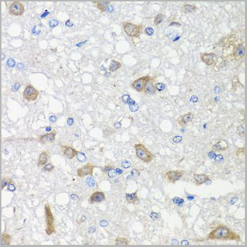 product-image-AAA10695_IHC2.jpg