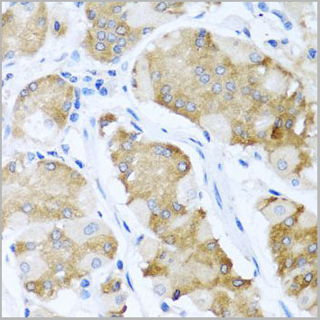 product-image-AAA10695_IHC3.jpg