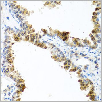 product-image-AAA10695_IHC4.jpg