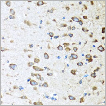 product-image-AAA10695_IHC5.jpg