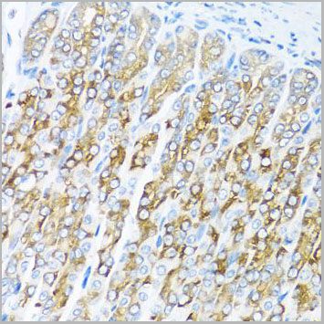 product-image-AAA10695_IHC7.jpg