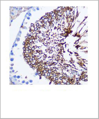 product-image-AAA10714_IHC2.jpg