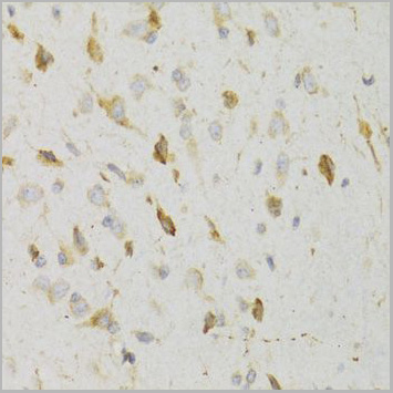 product-image-AAA10717_IHC2.jpg