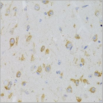 product-image-AAA10717_IHC4.jpg