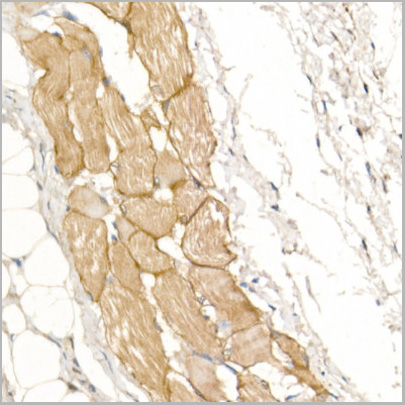 product-image-AAA10720_IHC2.jpg