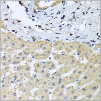 product-image-AAA10722_IHC2.jpg