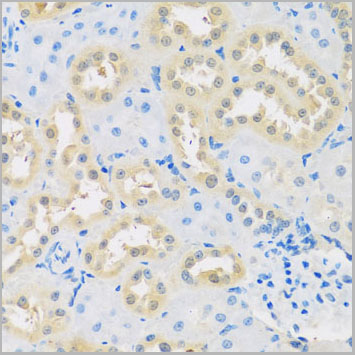 product-image-AAA10722_IHC3.jpg