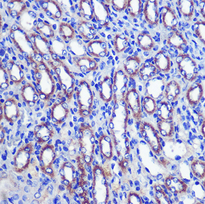 product-image-AAA10722_IHC5.jpg