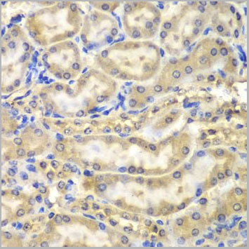 product-image-AAA10723_IHC3.jpg