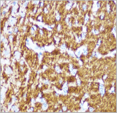 product-image-AAA10723_IHC4.jpg