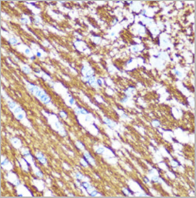 product-image-AAA10723_IHC5.jpg